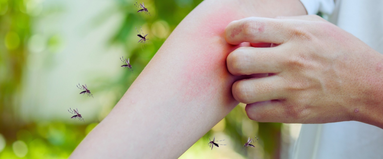 Mosquito Control in New Braunfels: How to Protect Your Yard This Summer